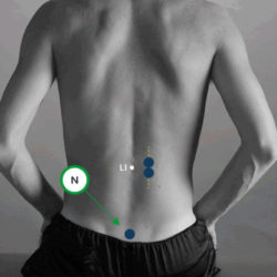 erector espinal L1 longissimus derecho