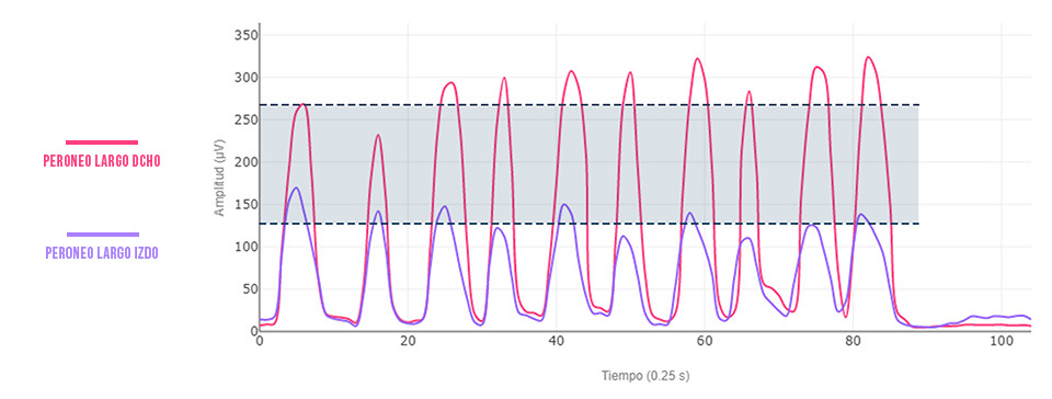 valoración inestabilidad crónica de tobillo puntas
