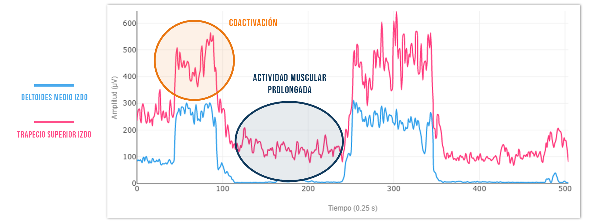 puntos gatillo coactivación muscular