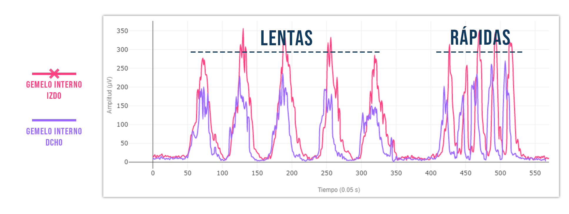 Tendinopatía aquilea | comparación de gemelos internos
