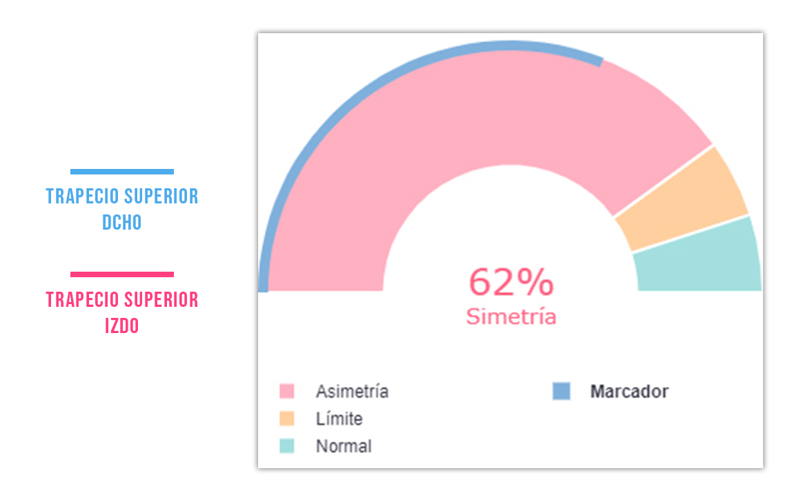 puntos gatillo (ejemplo trapecio) en el tono basal simetria
