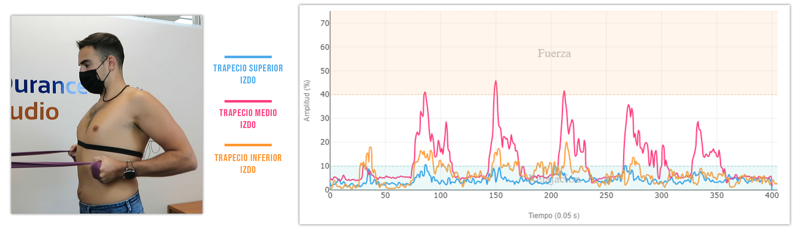 ejercicios de retracción escapular remo con 0° de abducción del hombro y 90º de flexión de codo.