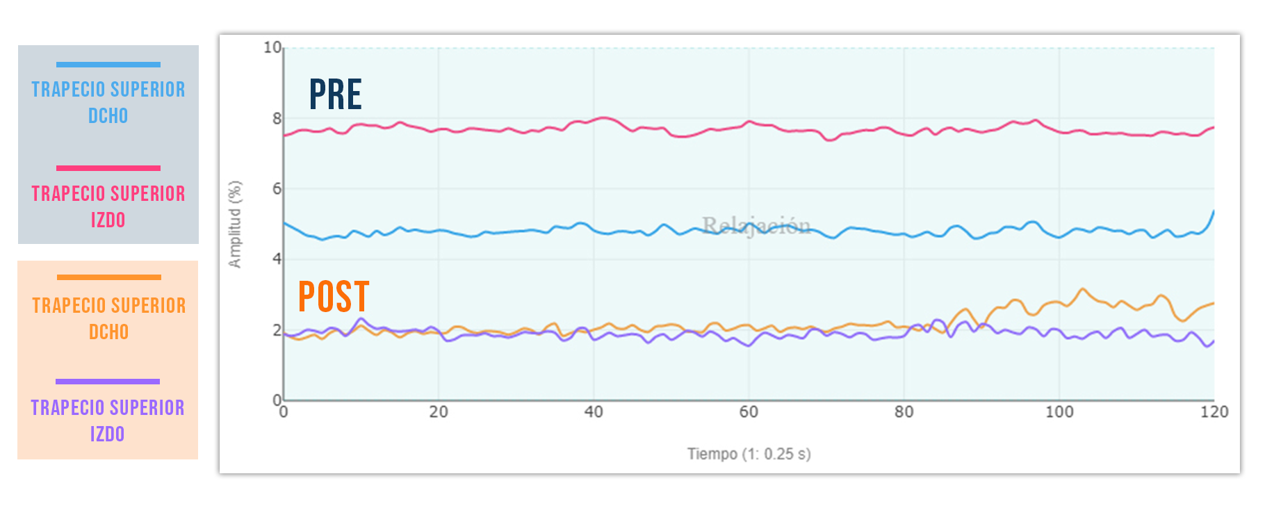 puntos gatillo (ejemplo trapecio) en el tono basal pre y post