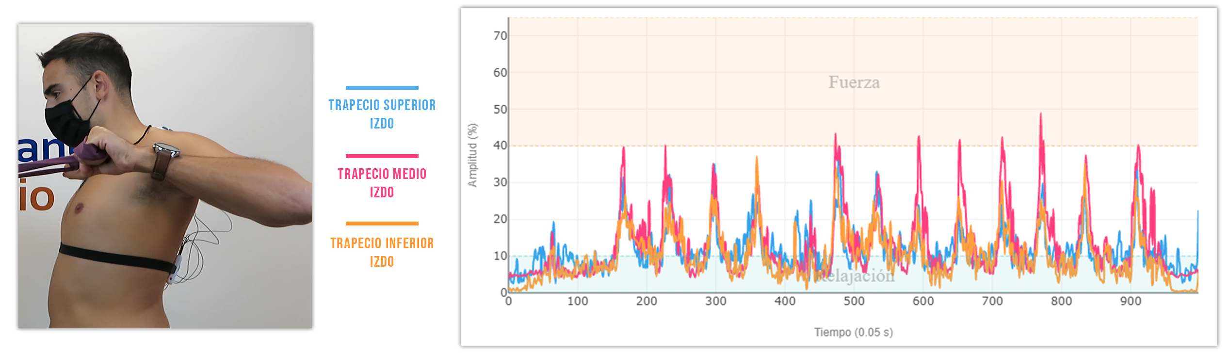 ejercicios de retracción escapular Remo con 90° de abducción del hombro y 90° de flexión del codo.