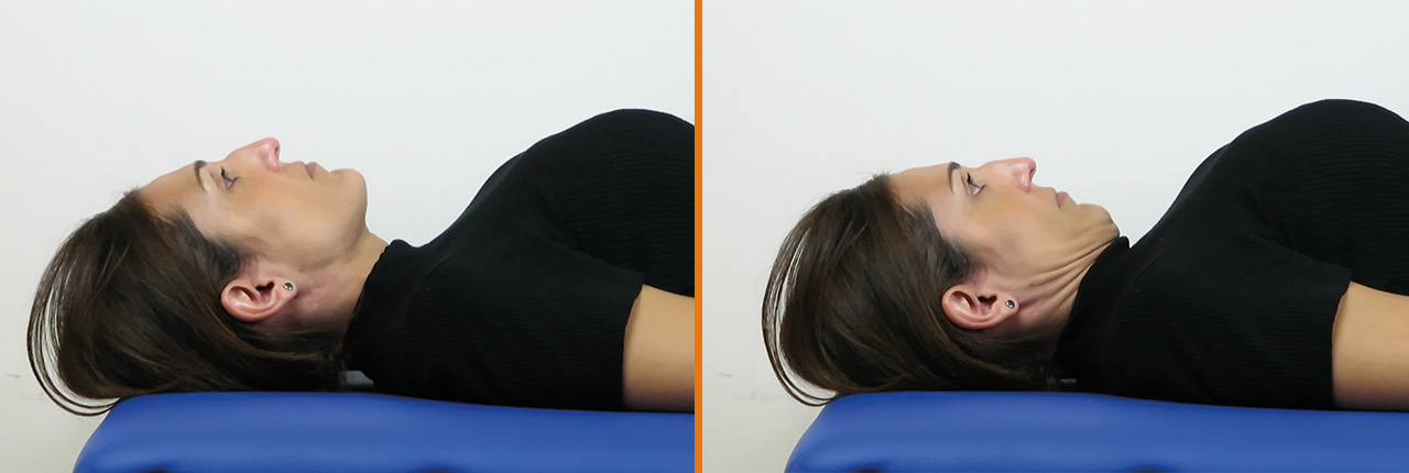 Prueba flexión craneo-cervical dolor cervical