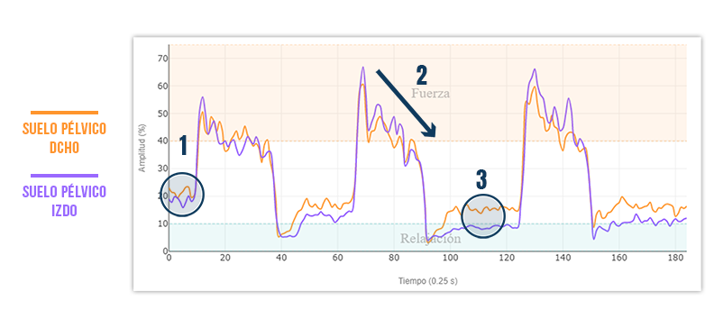 disfunción relajación del suelo pelvico en paciente real