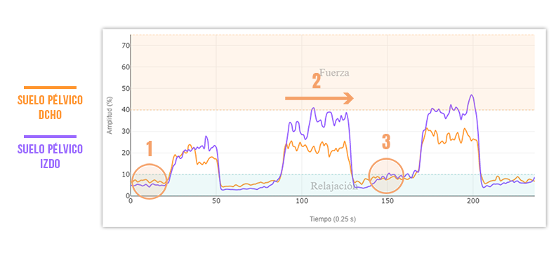 contracción correcta del suelo pélvico. Relajación vs contracción