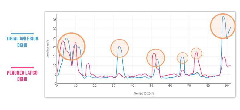 son eficaces las plantillas de podoactiva (valoración neuromuscular)