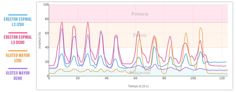 patrón anómalo en la extensión de cadera