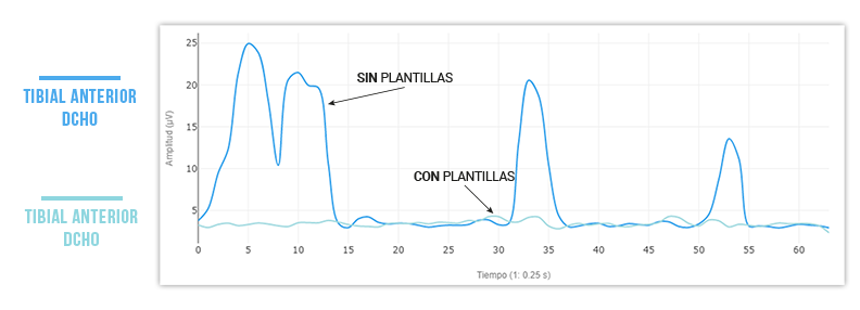 eficacia podoactiva con y sin plantillas bipedistación