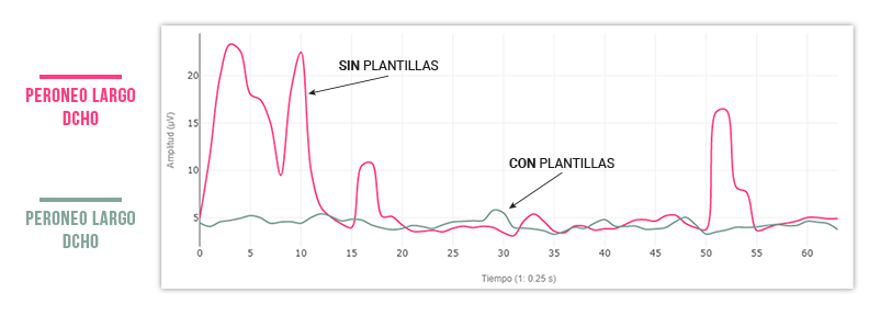 con y sin plantillas podoactiva en bipedistación 2