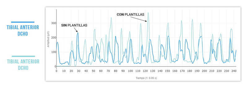 con y sin plantillas podoactiva caminando valoracion neuromuscular
