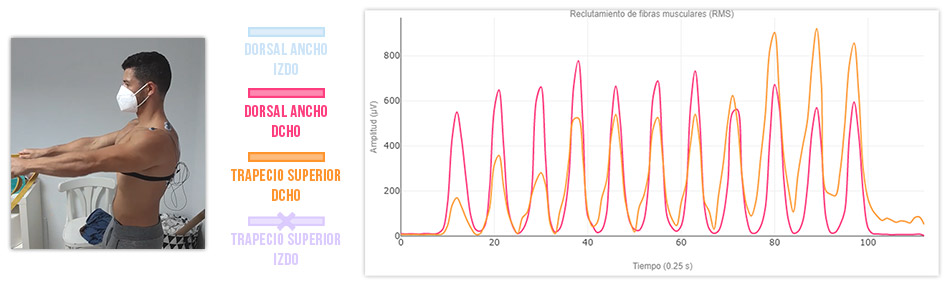 ejercicio 1 dorsal ancho y trapecio superior