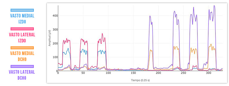 gráfica actividad muscular