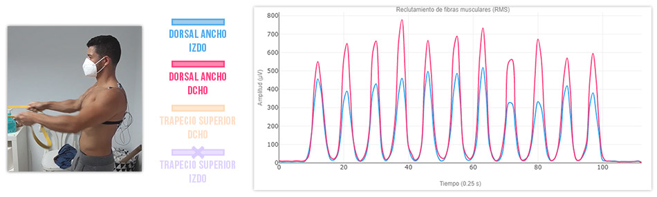 comparación activación muscular dorsal ancho (ambos lados)