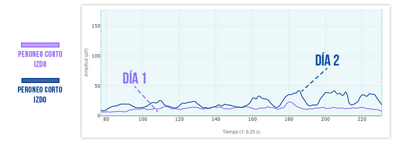 Gráfica evolutiva terapia imaginería motora