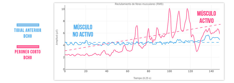 Gráfica actividad muscular usando imaginería motora