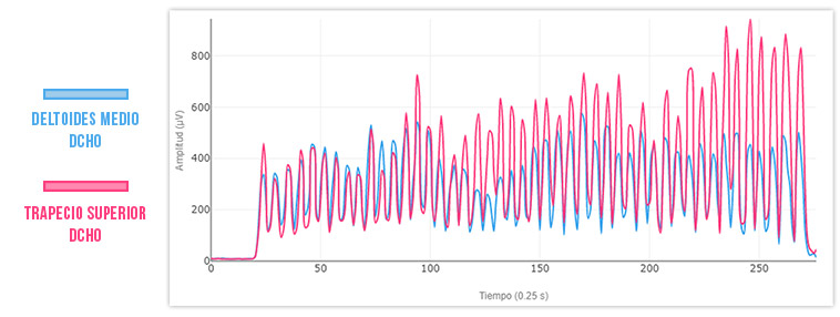 tipo de fatiga muscular por repetición