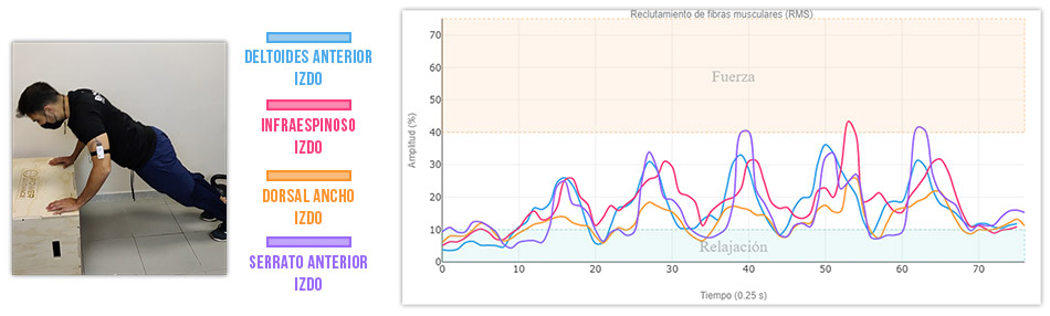 grafica actividad muscular variantes de flexiones con apoyo