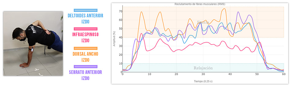 grafica actividad muscular isometricas