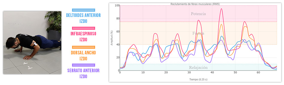 grafica actividad muscular normal