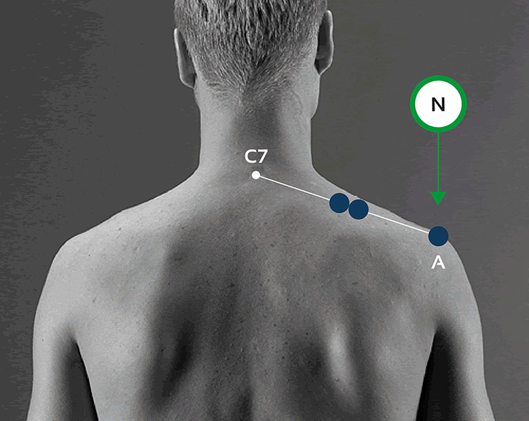 colocación de electrodos en mDurance