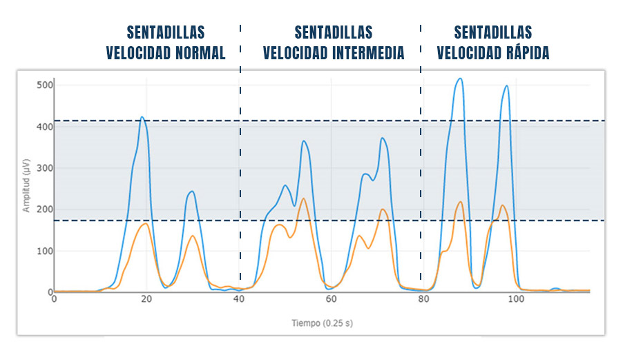 Ejemplo de variabilidad en la medición de electromiografía