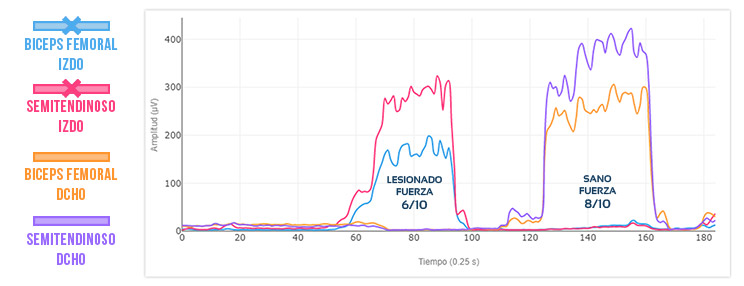 inhibicion en lesión de isquiotibiales: Resultado 1