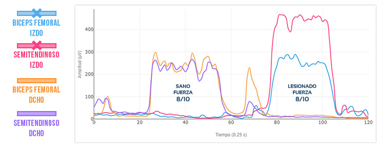 ineficiencia en lesión de isquiotibiales: Resultado 2