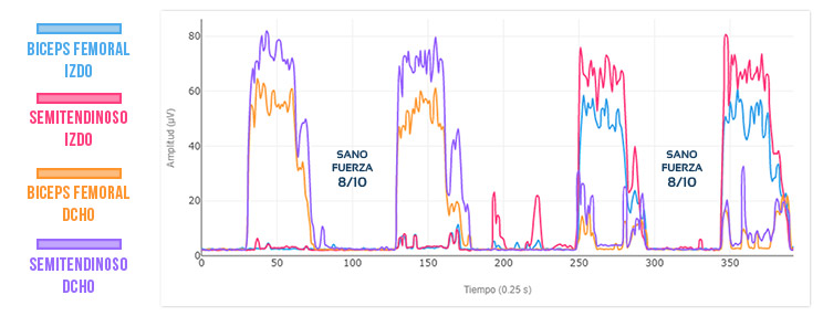 Resultado esperado en lesión de isquiotibiales (actividad muscular)