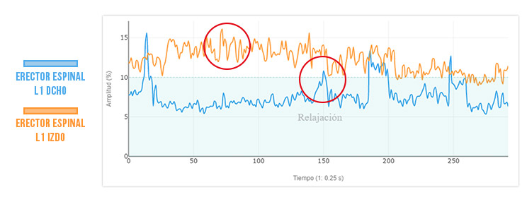 VALORACION ERECTORES ESPINALES EN ACTIVACION DEL TRANSVERSO DEL ABDOMEN