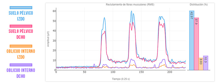 buena sinergia muscular en el suelo pélvico (fuerte)