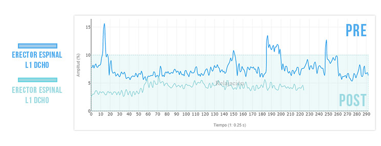 post evaluacion de los erectores al activar transverso