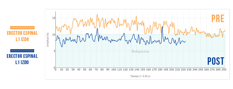post evaluacion de los erectores al activar transverso del abdomen