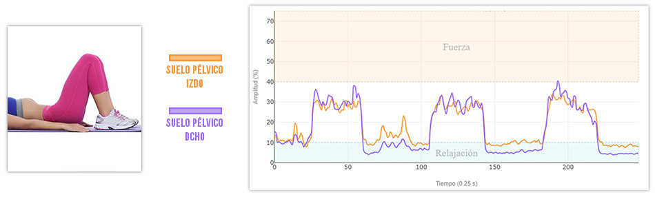 contracciones isometricas de suelo pelvico