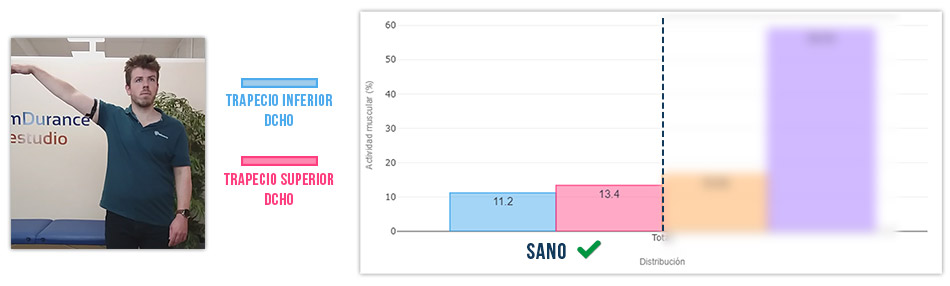 trapecio inferior vs trapecio superior abducción de hombro (bien)