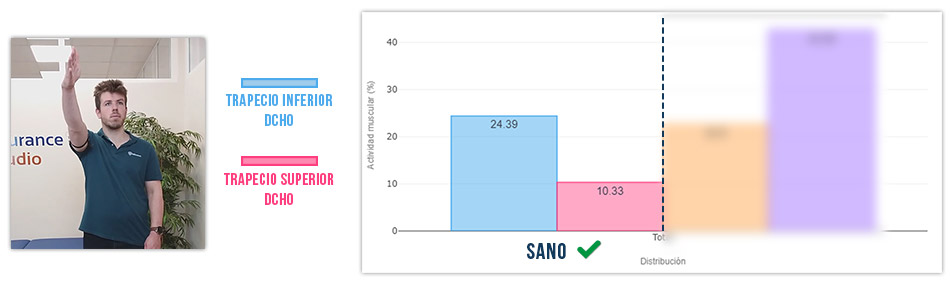 trapecio inferior vs trapecio superior flexión de hombro (bien)