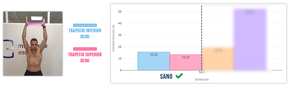 trapecio inferior vs trapecio superior press de hombro (bien)