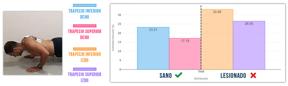 comparación sinergia trapecio superior vs inferior en flexion de brazos
