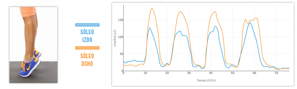 comparativa actividad muscular soleo izquierdo vs derecho