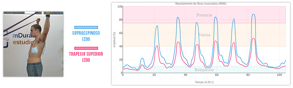 ejercicio de Y activación del supraespinoso vs trapecio superior