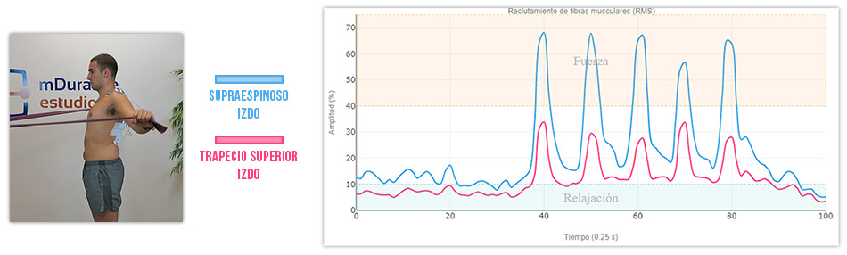 ejercicio de T activación del supra vs trapecio superior