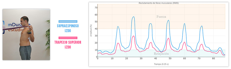 ejercicio de W activación del supra vs trapecio superior