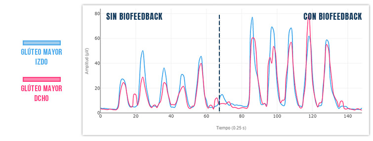 electromiograma con y sin biofeedback
