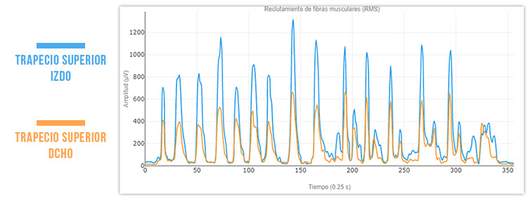 trapecio superior comparación prueba inicial