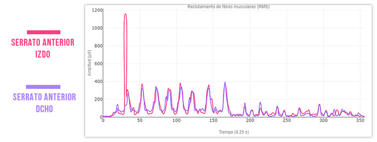 serrato anterior comparación prueba inicial