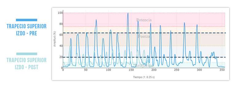 trapecio superior post tratamiento