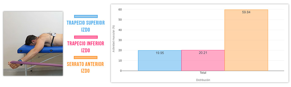 actividad serrato vs trapecio superior en bipedestación