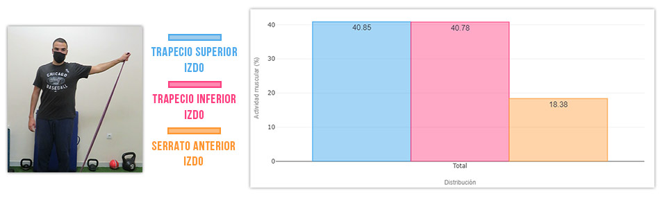 actividad serrato vs trapecio superior en decúbito prono
