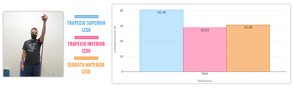 actividad serrato vs trapecio superior en bipedestación (flexión de hombro)